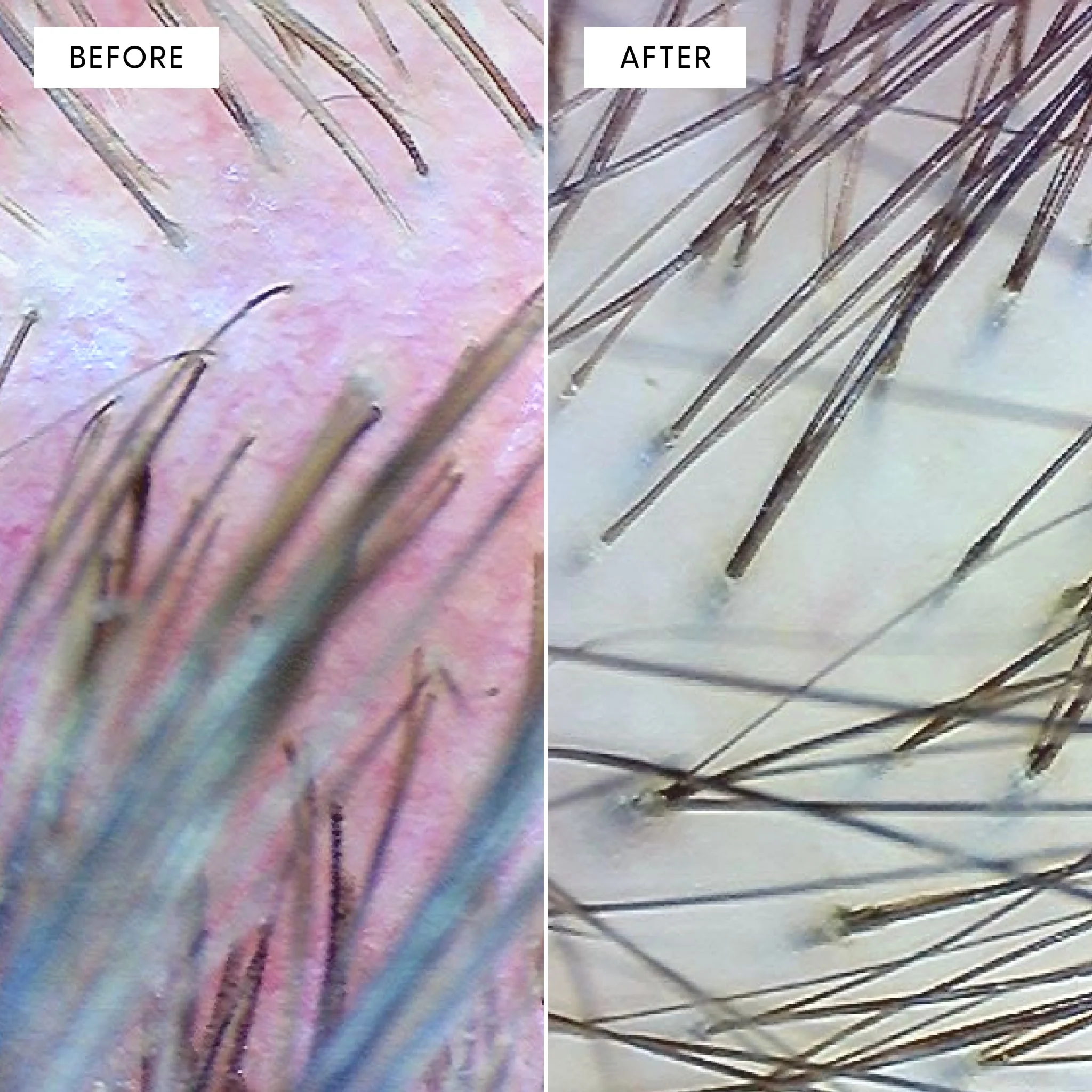 Calm It Down Scalp Serum - Image 4