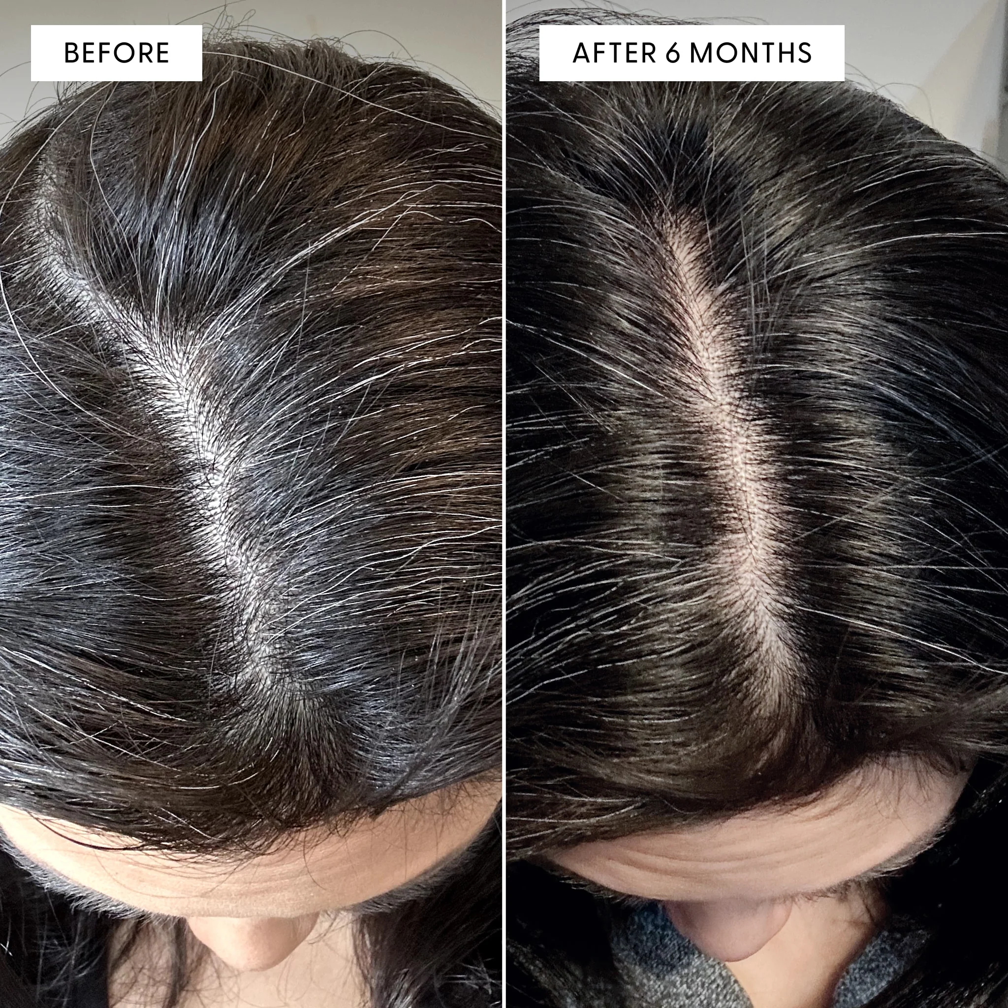 To The Root® Scalp Serum - Image 4